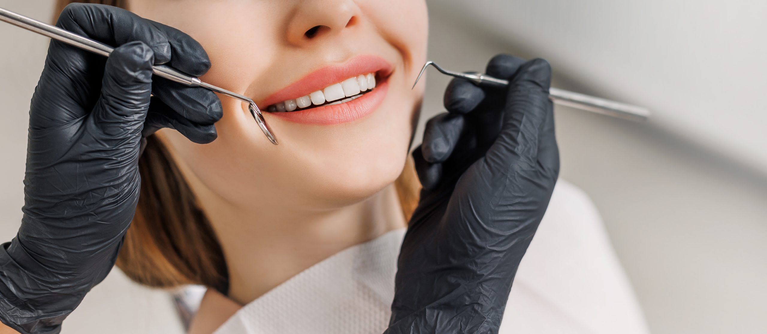 What Teeth Look Like Under Veneers | Best Dental