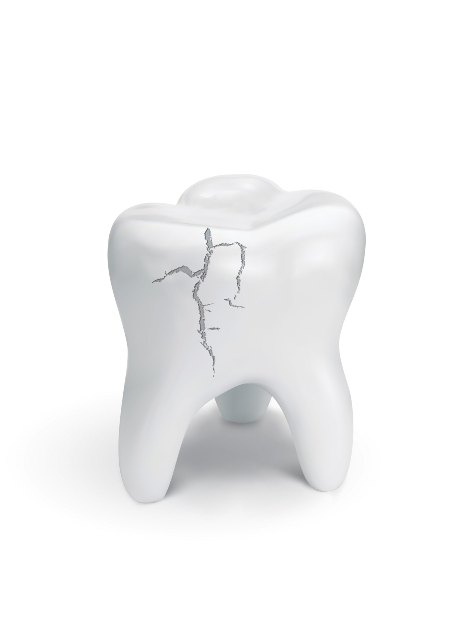 Extraccion de muelas del juicio en Houston, TX | Best Dental