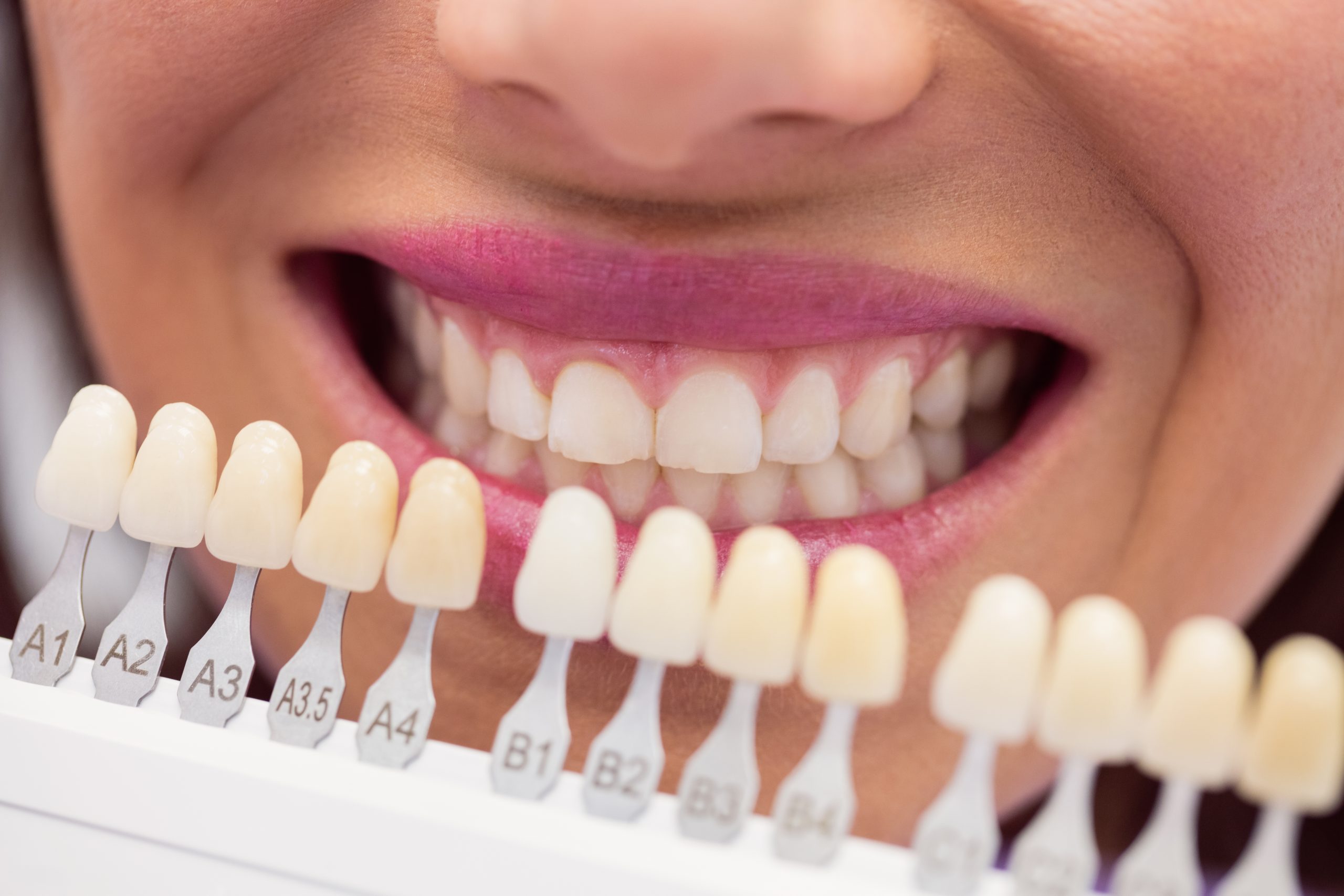 Cosmetic Dentistry in Houston, TX | Dr. Jasmine Naderi at Best Dental