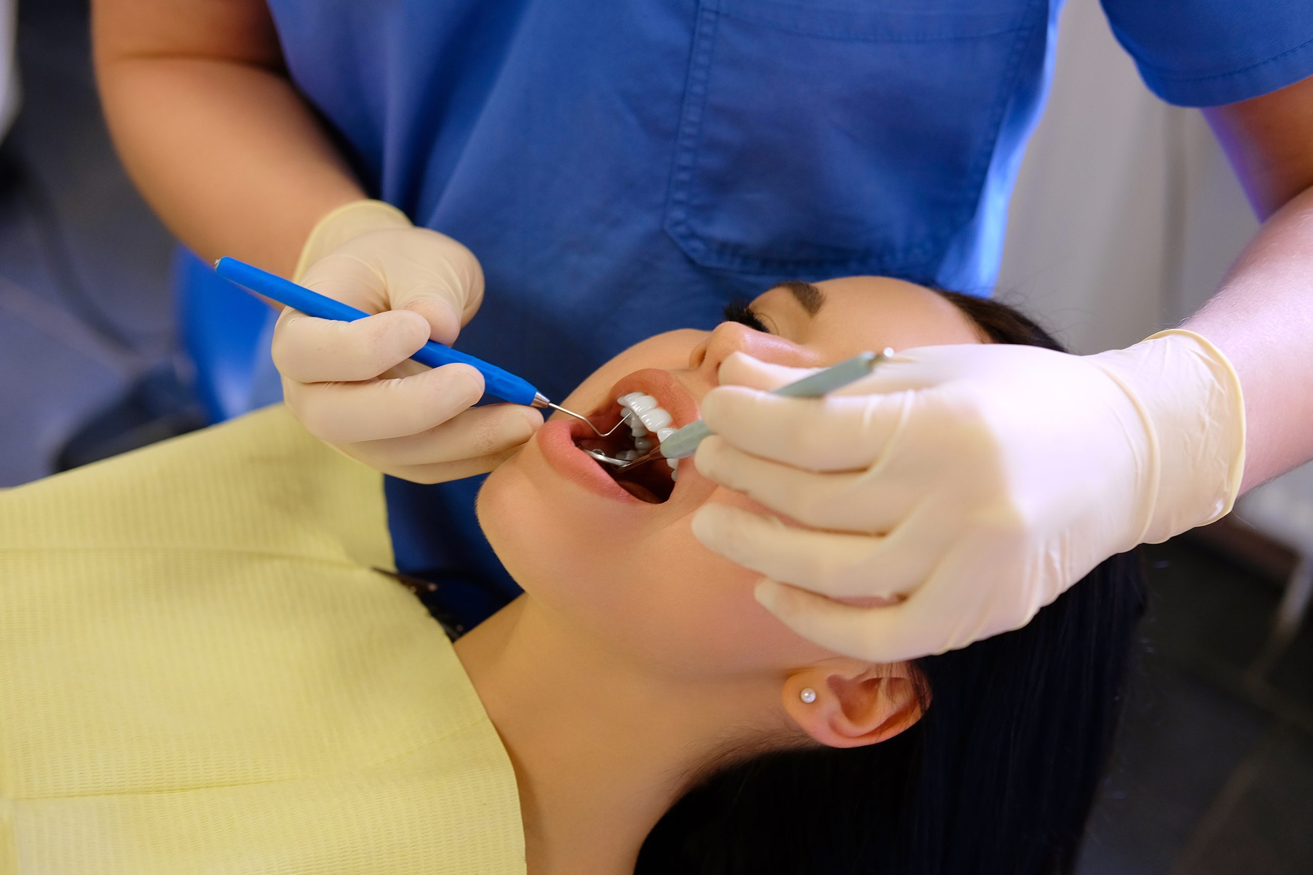 Dental Crown After Root Canal | Best Dental