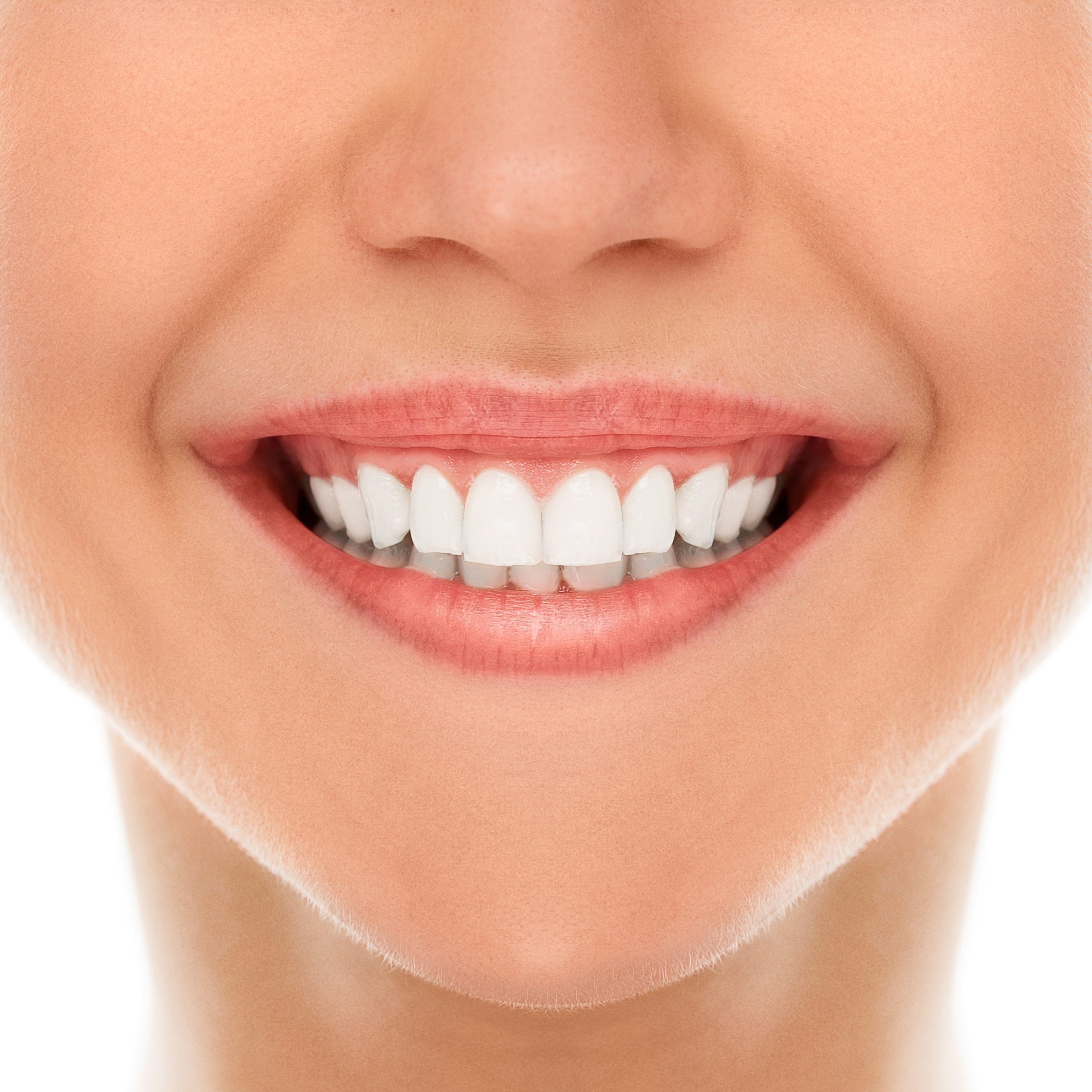 Feldspathic Porcelain Veneers An Overview