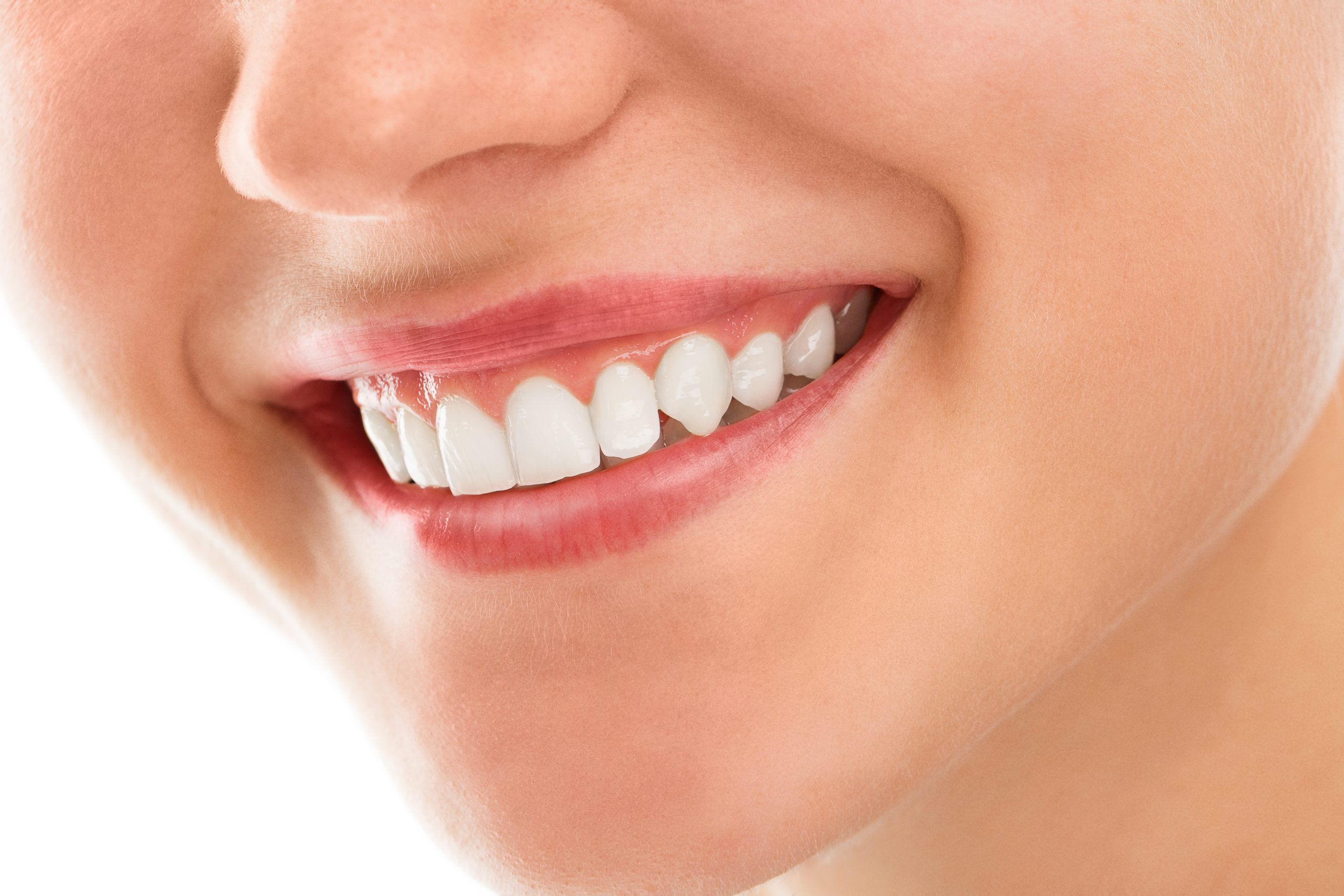 E-Max Dental Veneers | Best Dental