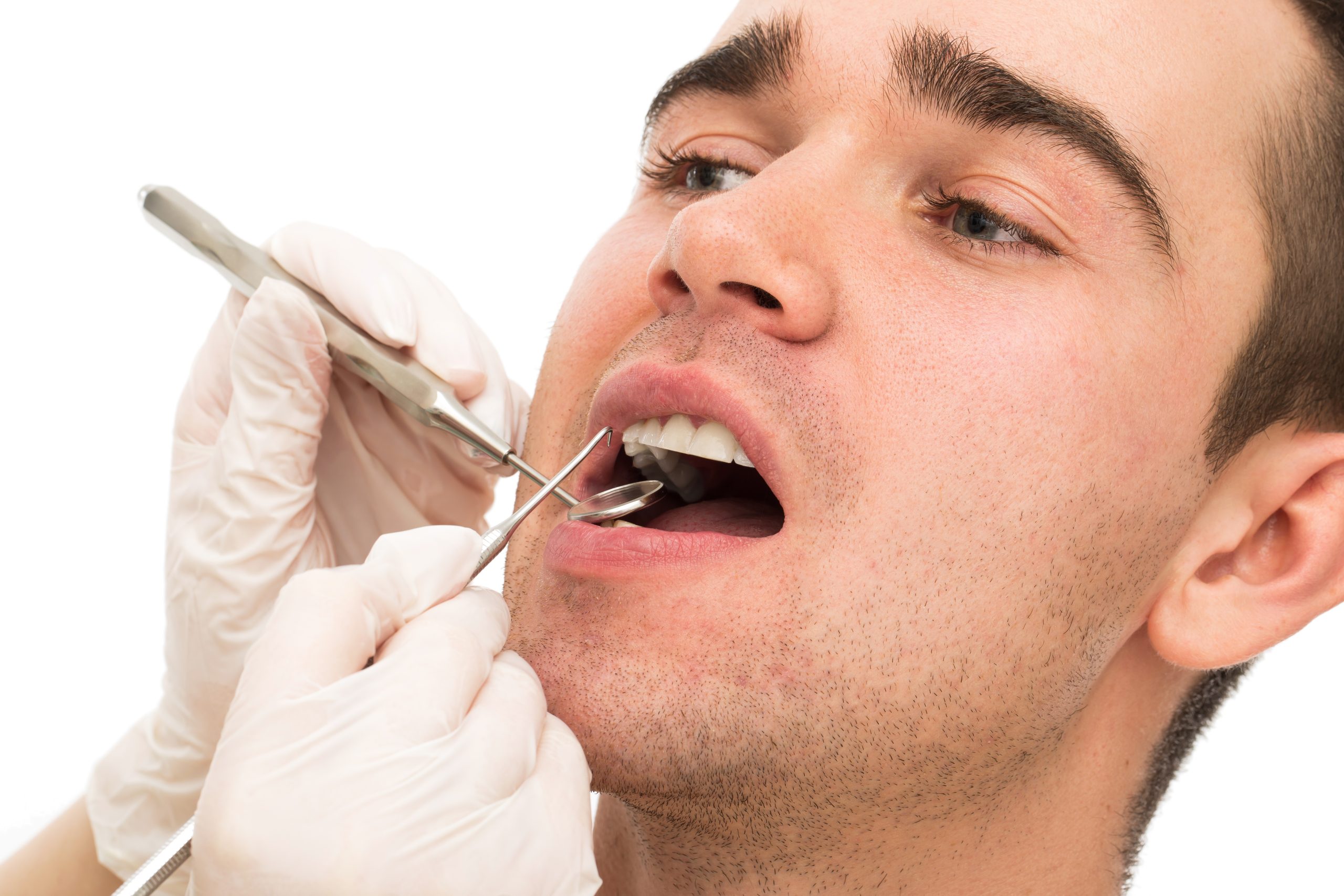 Tooth Extraction Houston, TX | Best Dental