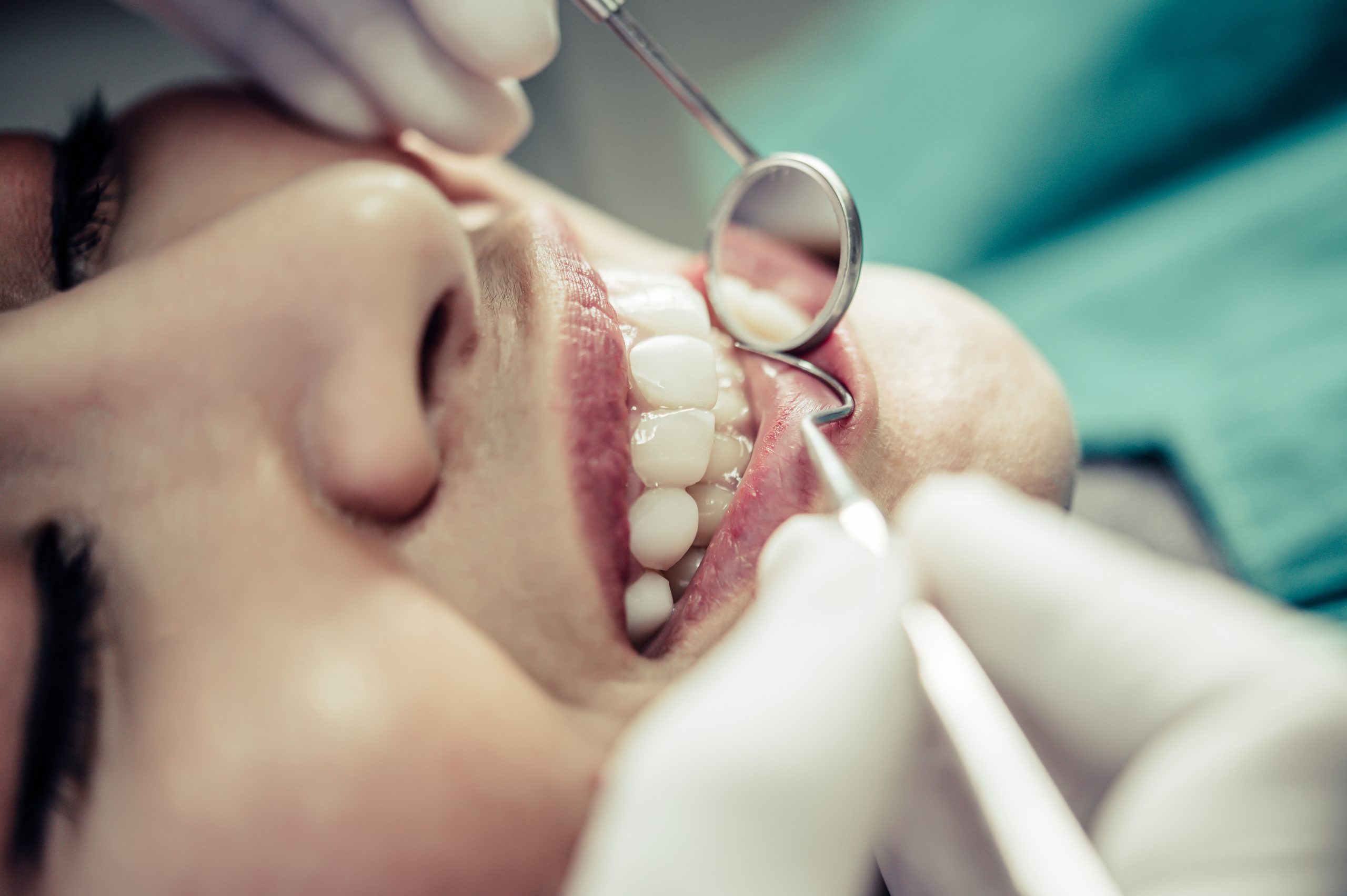 Puente Dental En Houston | Best Dental