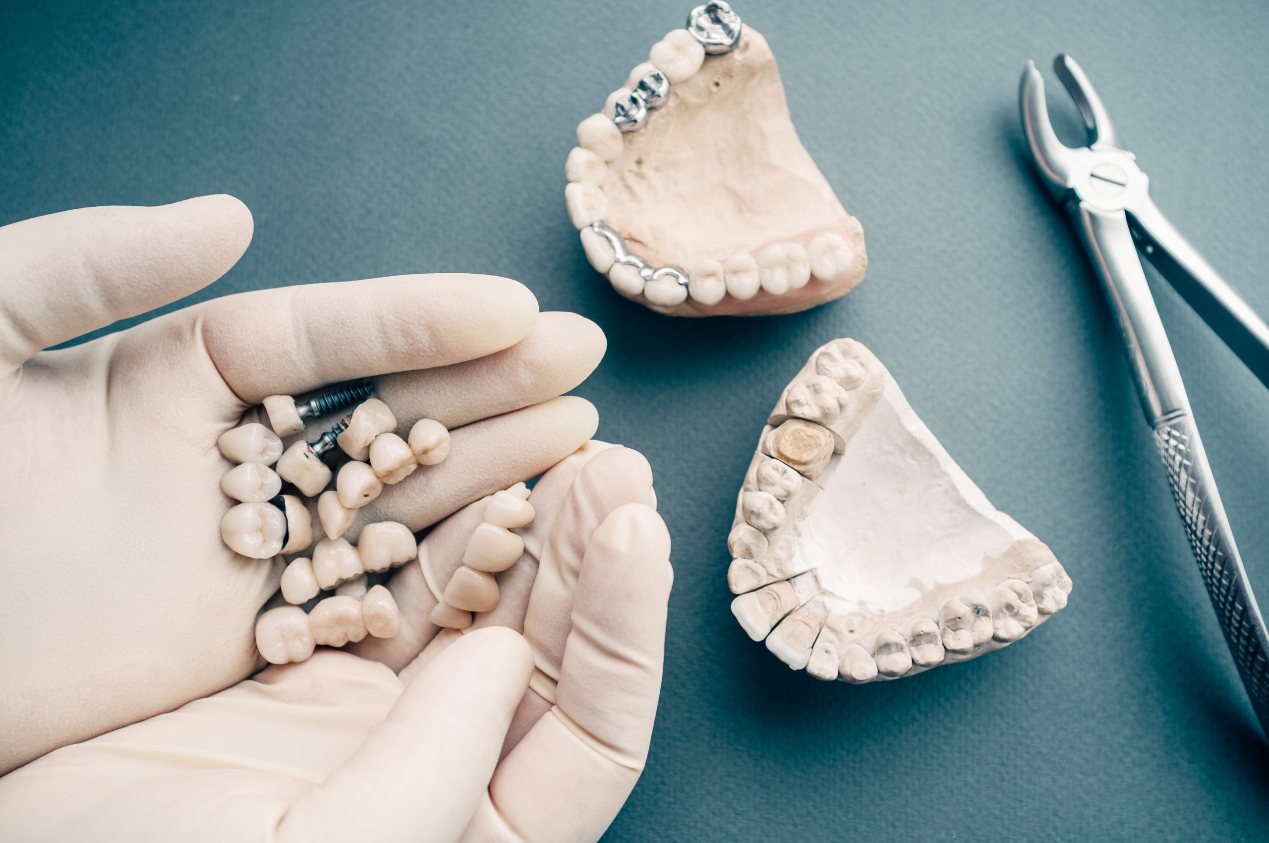 Dental Bridge Houston, TX | Best Dental