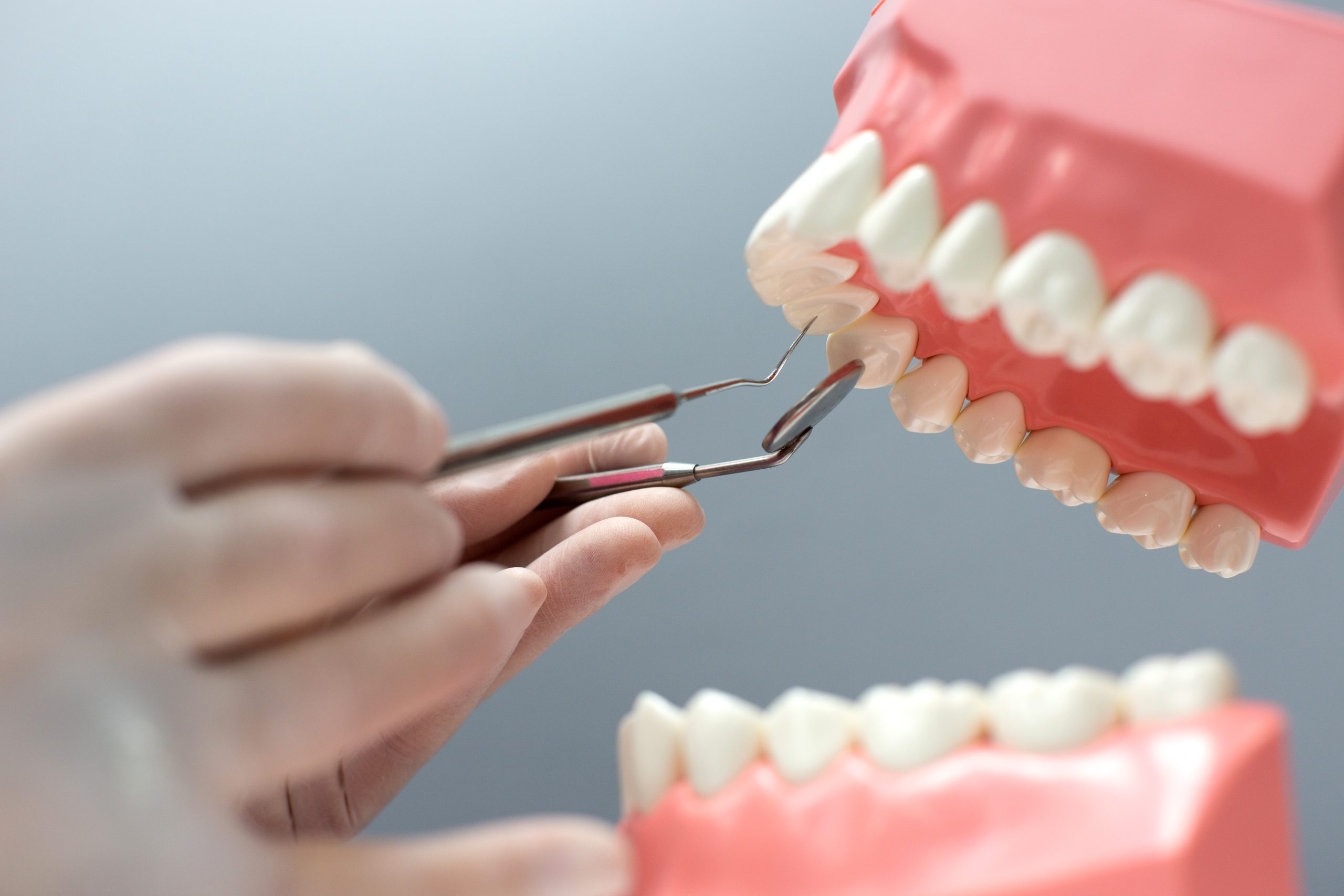 Dental Crown After Root Canal | Best Dental