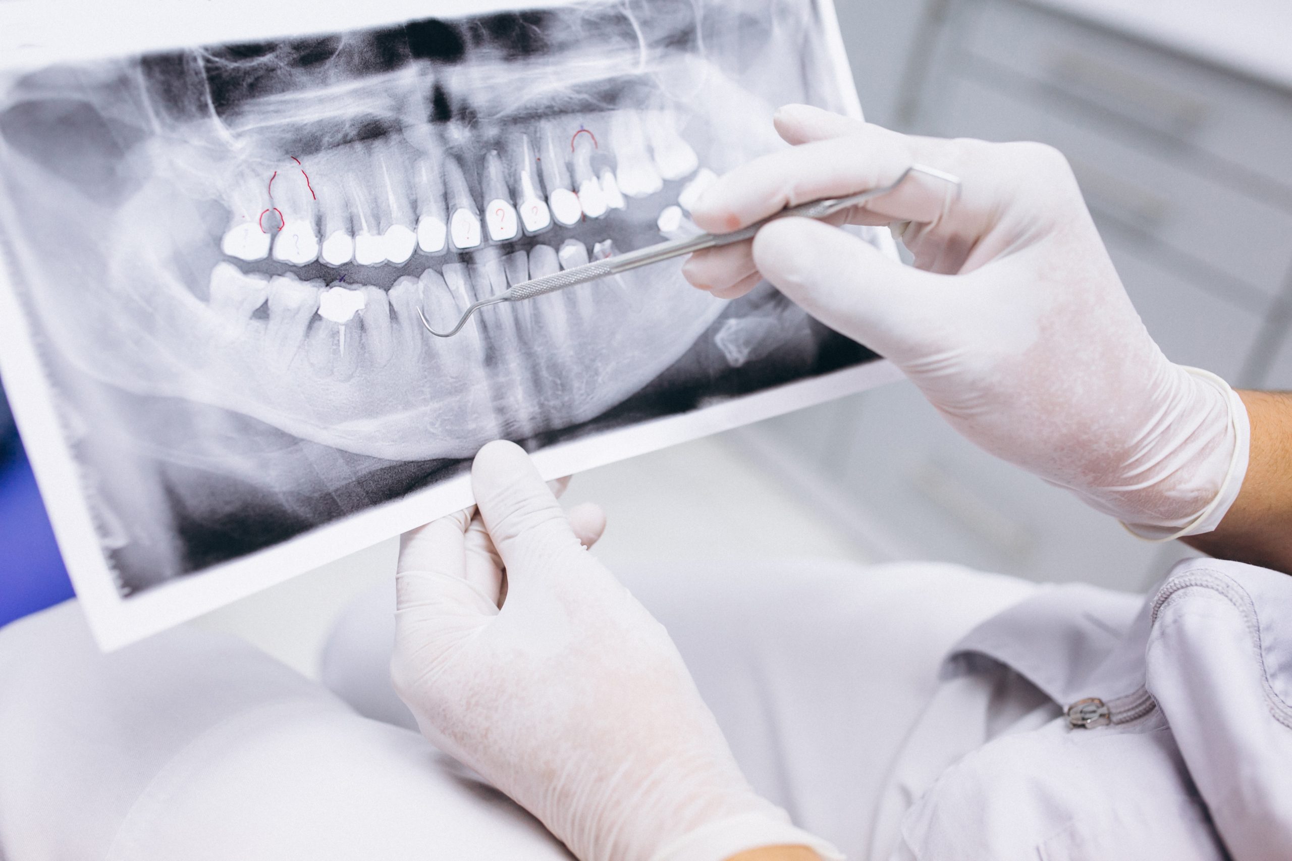 Tooth Broke Black Inside | Best Dental