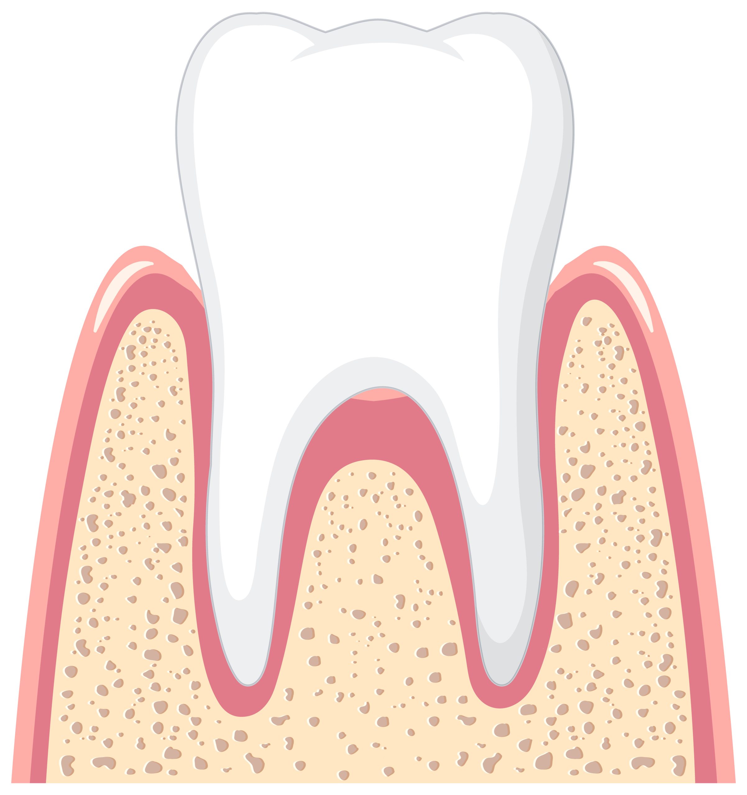 IV Sedation For Wisdom Teeth An Overview Best Dental