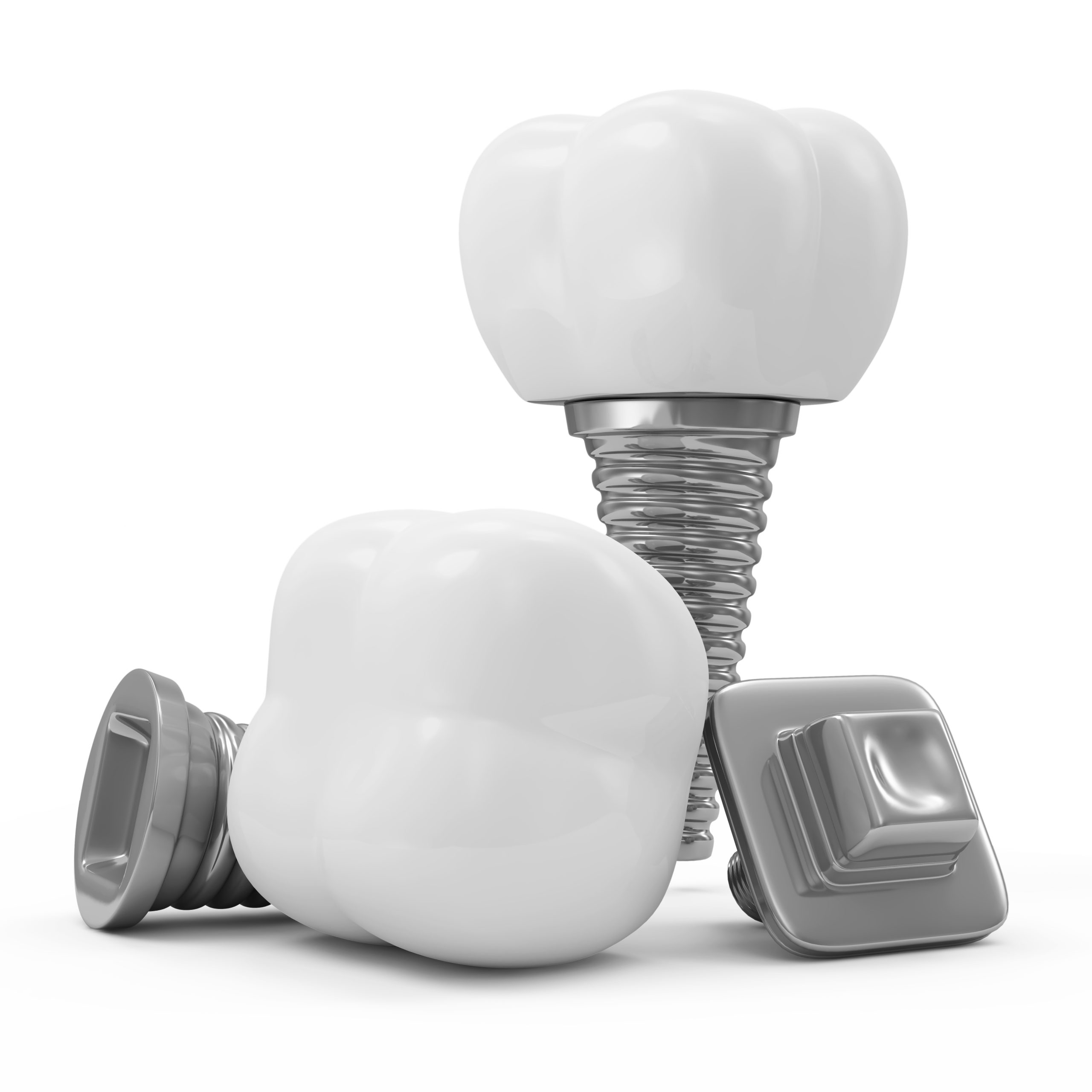 How Much Do Dental Implants Cost? | Best Dental