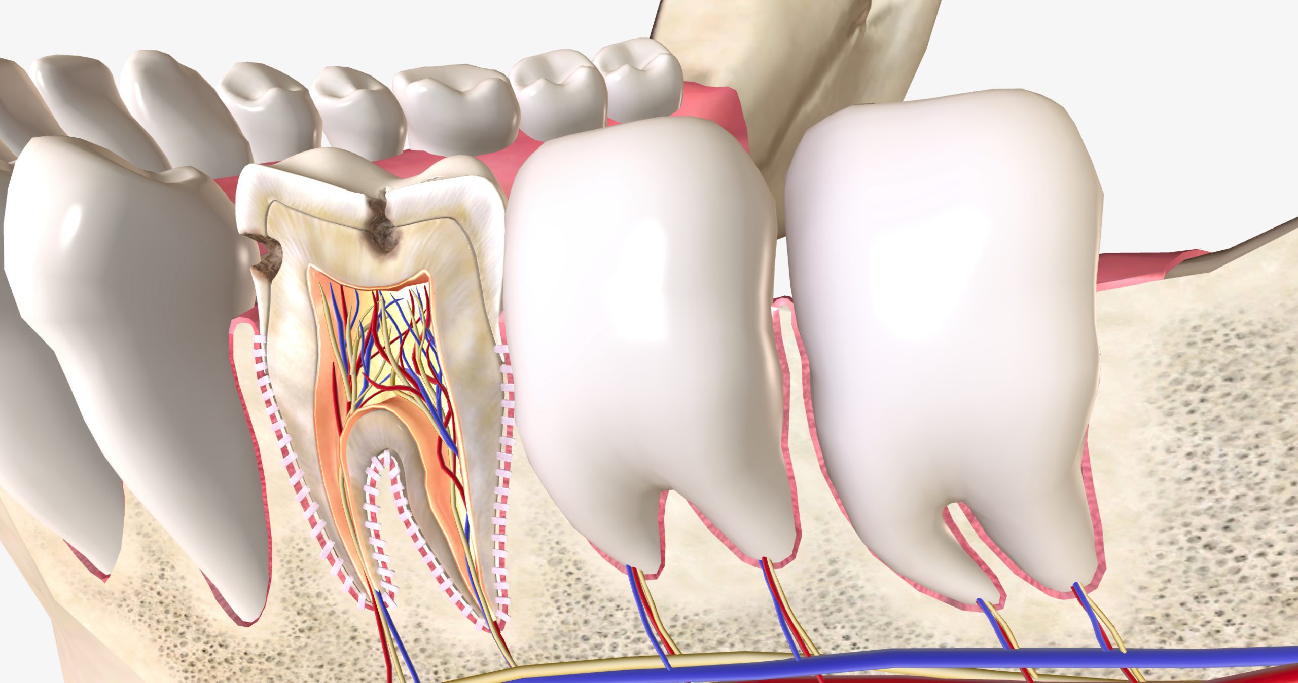 Dental Fillings VS Root Canals Best Dental