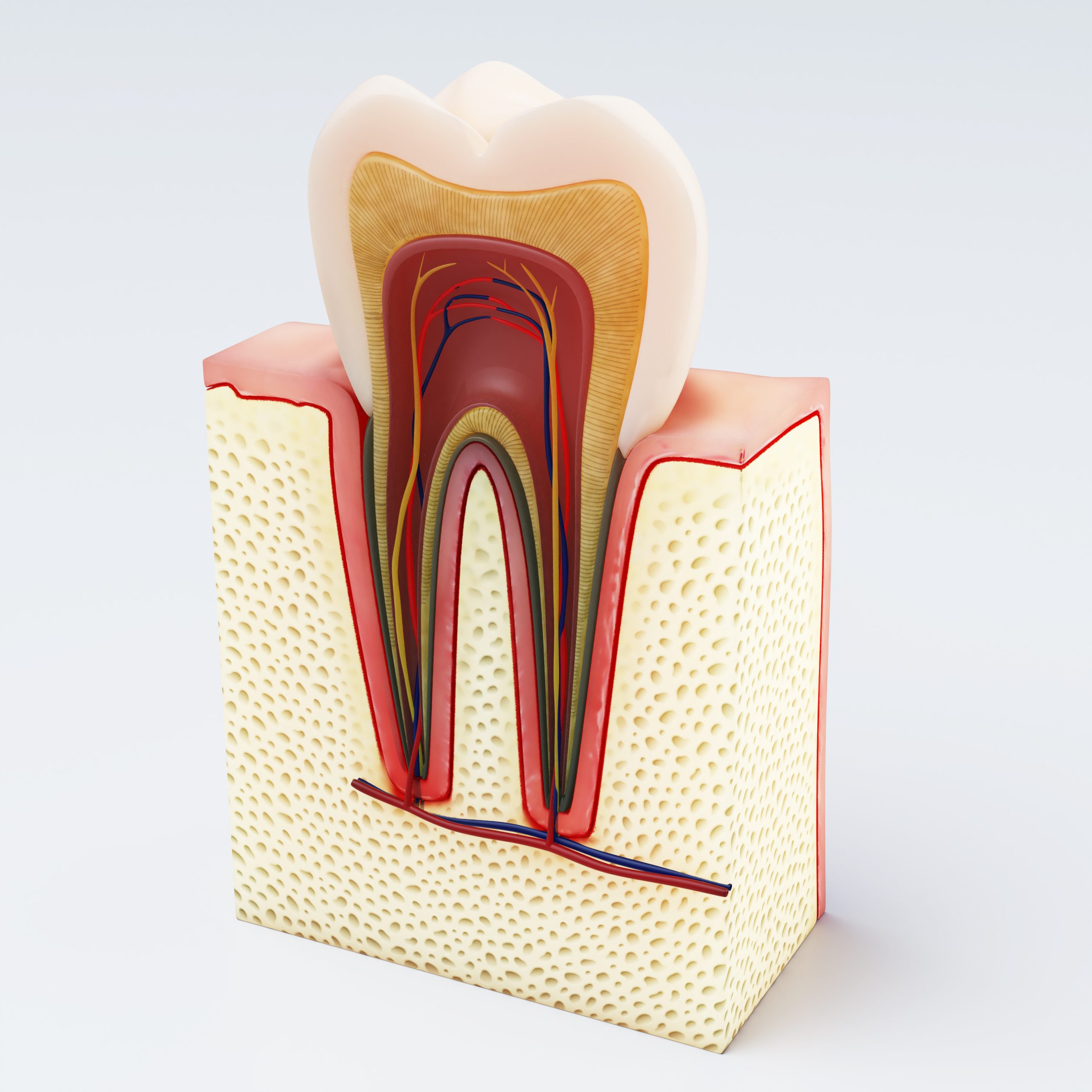 Dental Fillings VS Root Canals