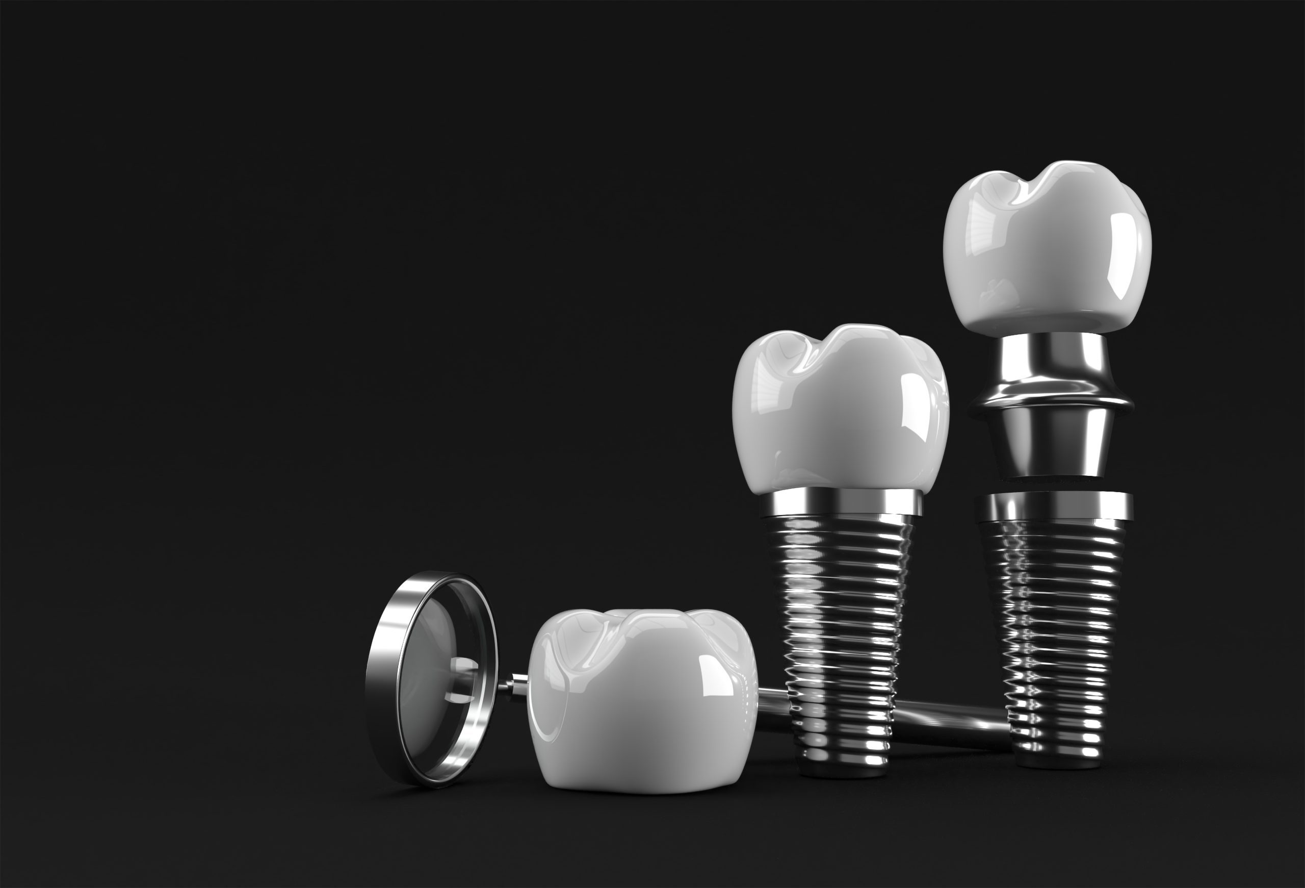 Is A Dental Bone Graft Worth It? | Best Dental