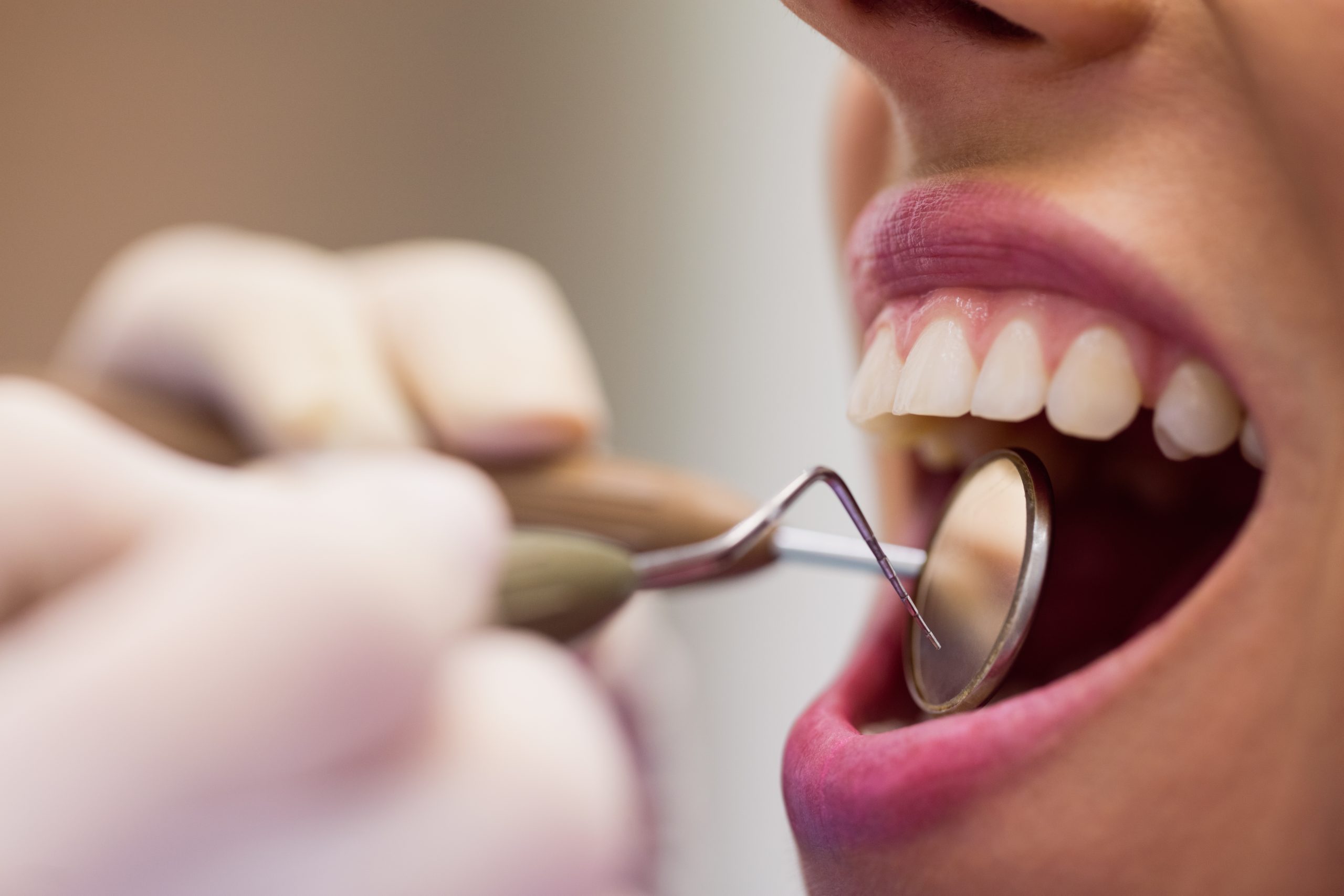 What Does Cosmetic Dentistry Include? | Best Dental