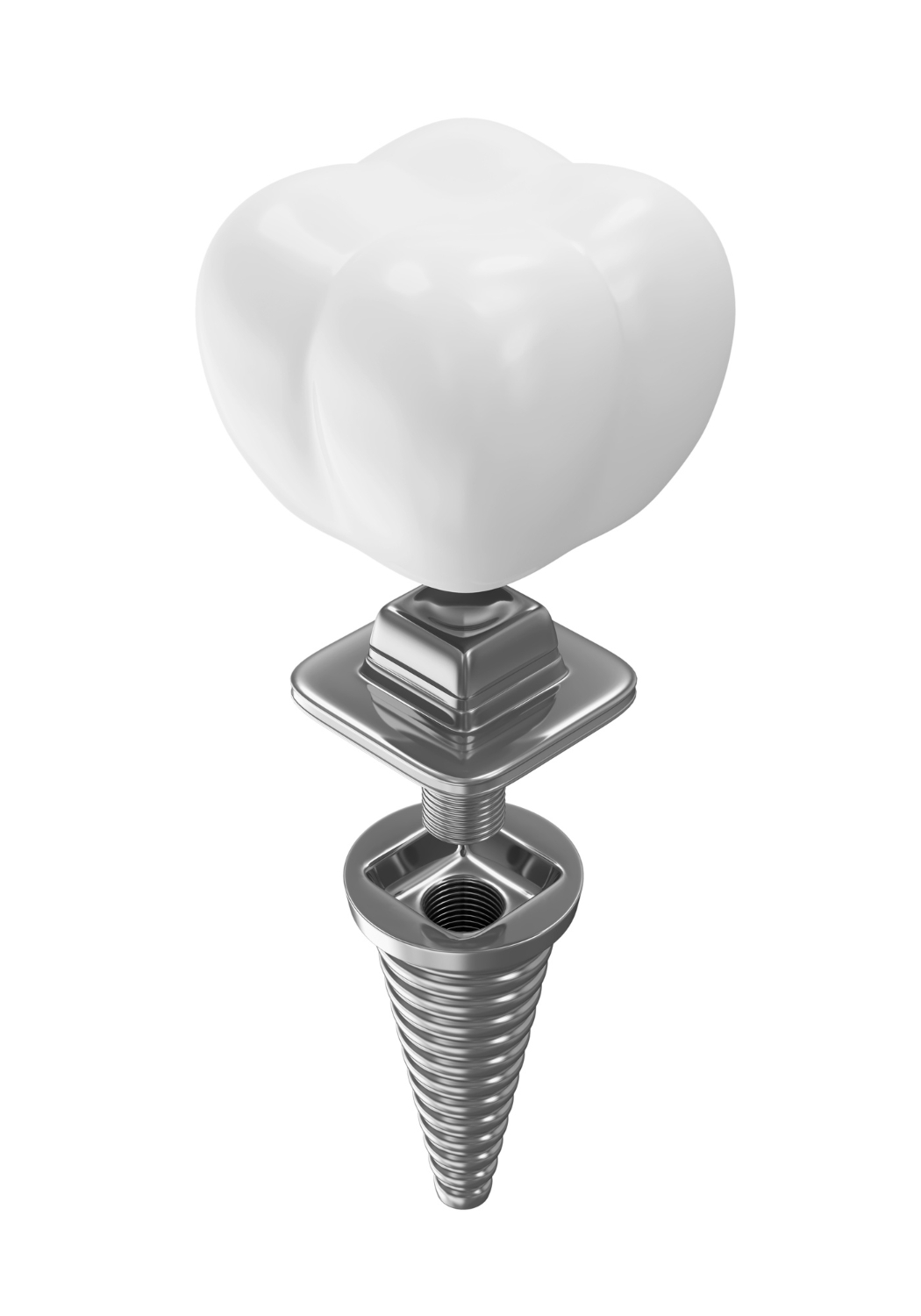 Emergency Dental Implants In Houston | Best Dental in TX