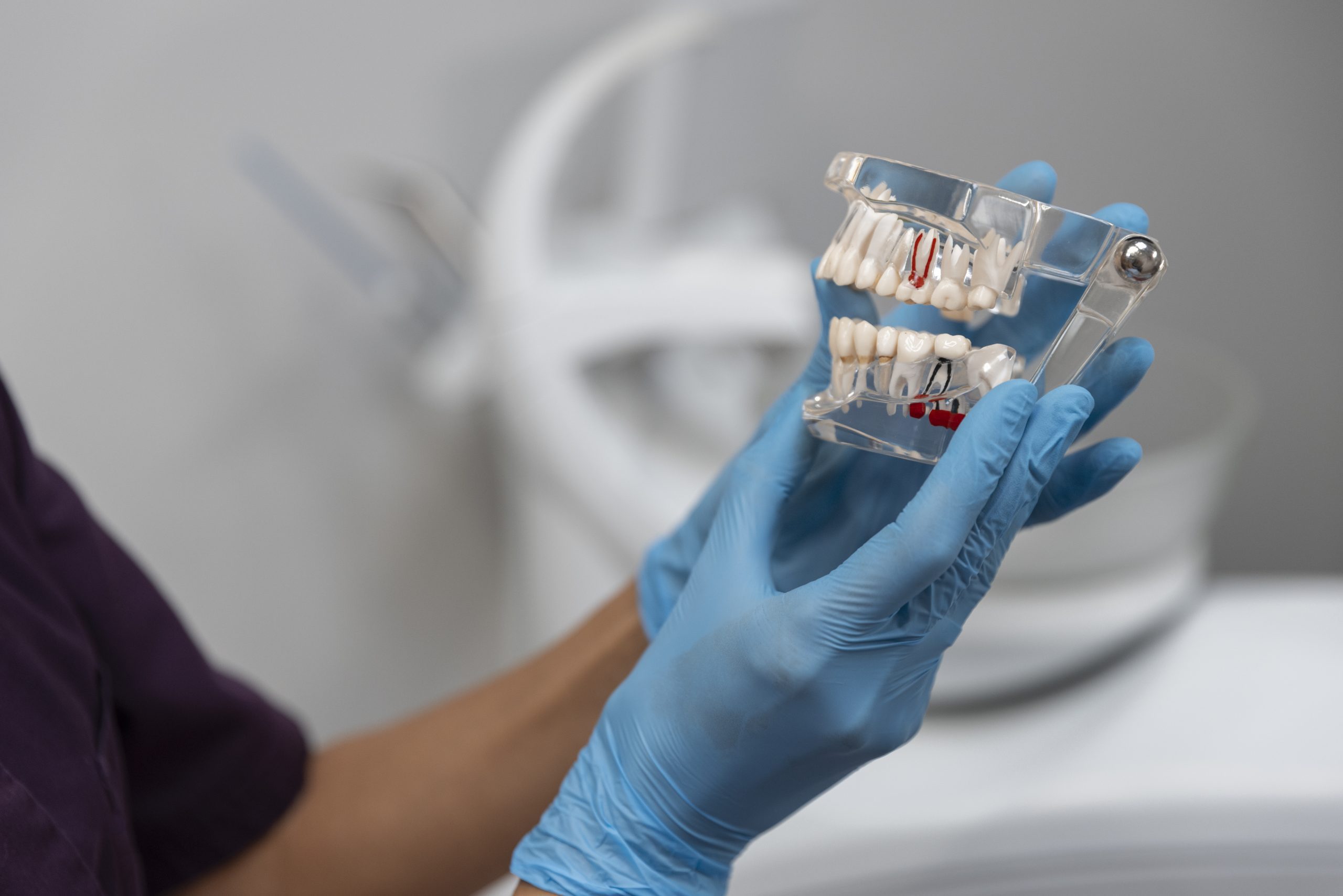 Dental Bridge Treatment | Best Dental