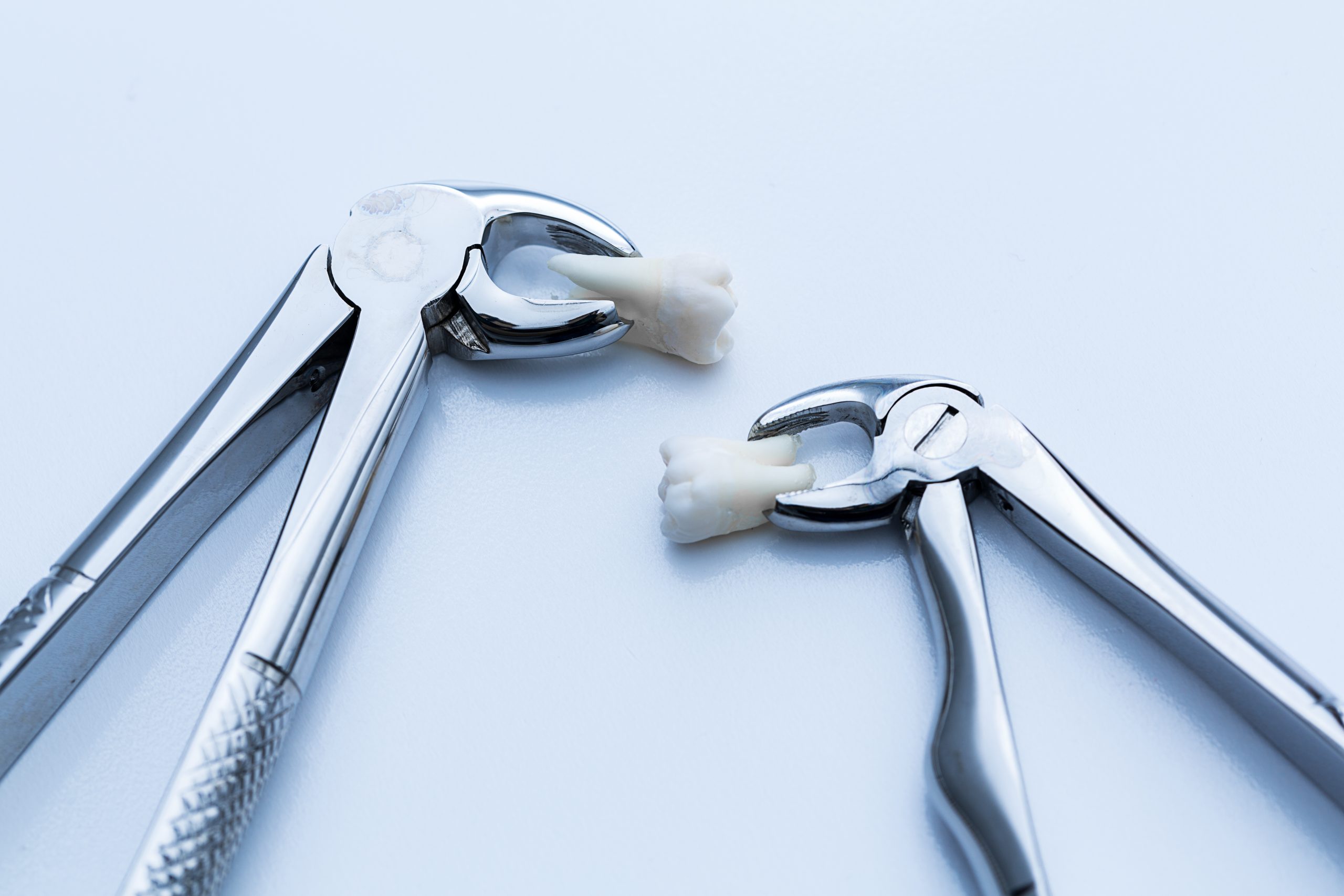 How Painful Is A Tooth Extraction?