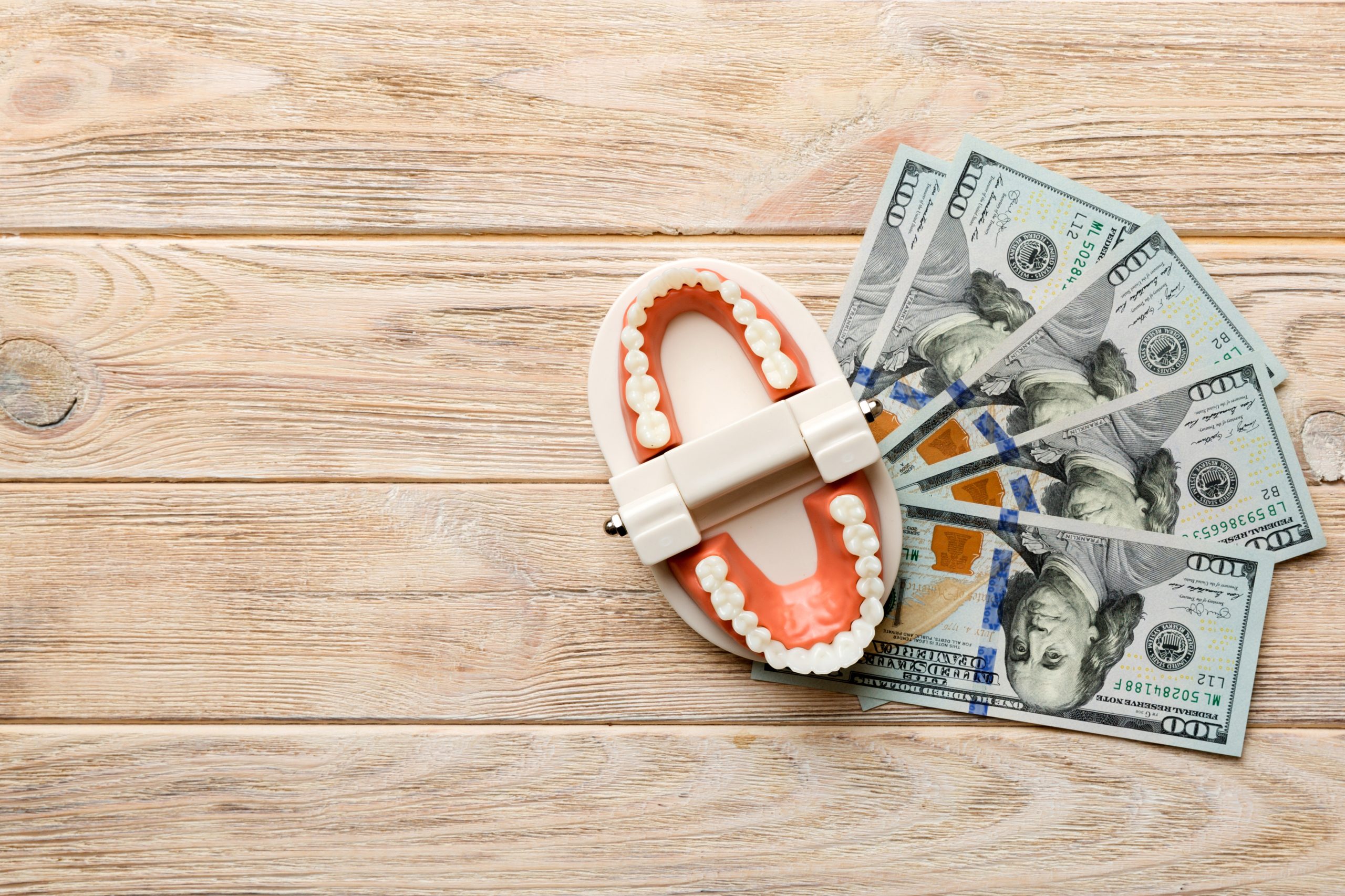 Root Canal Financing Houston | Best Dental