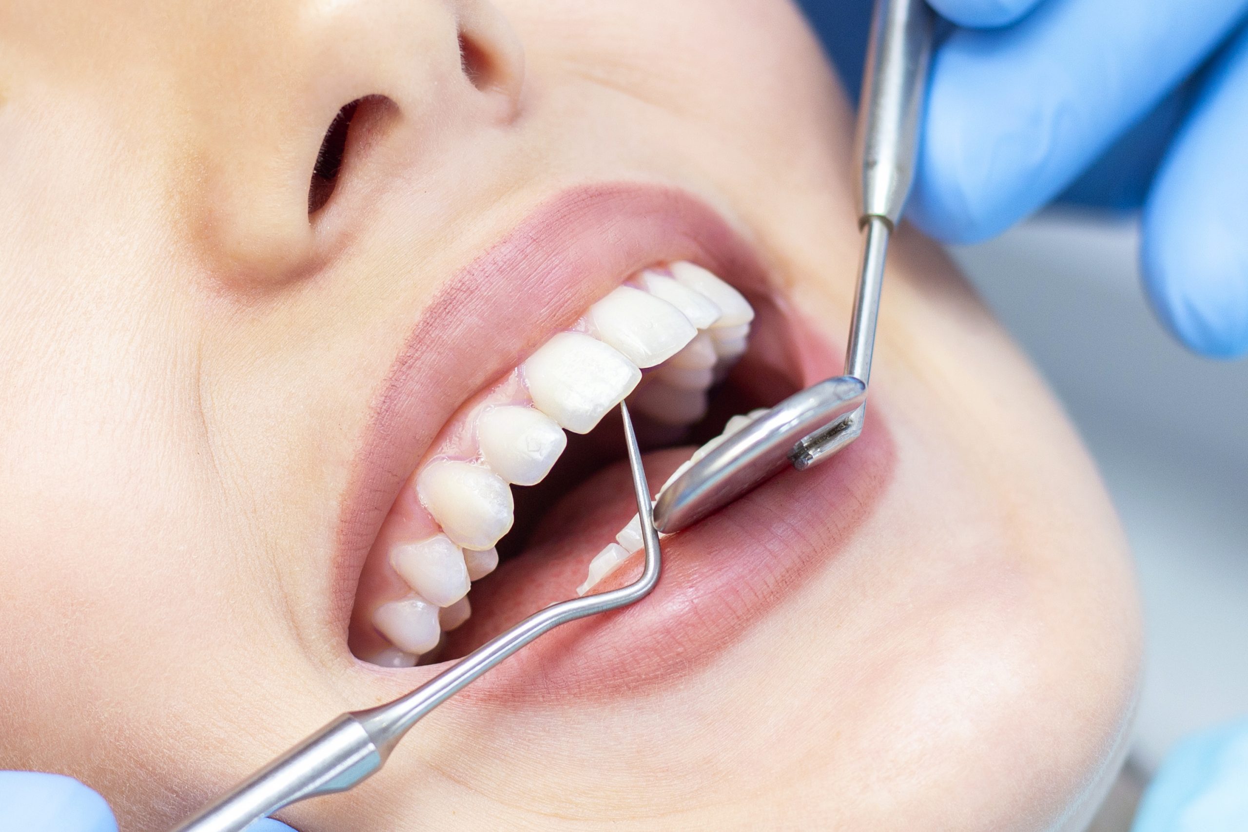 In-Network Dentist Near Me | Best Dental in Houston, TX
