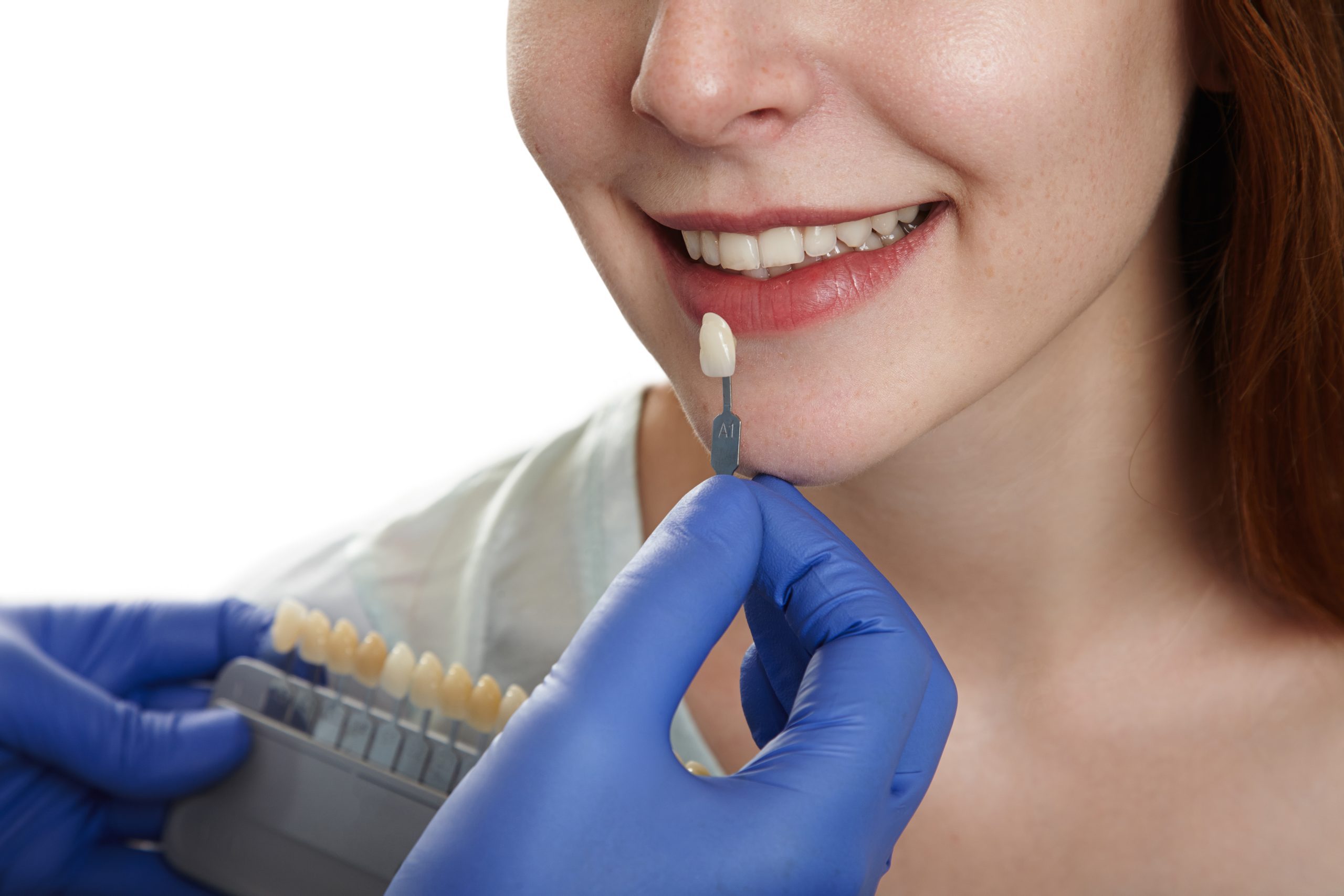 Managing After Dental Implant Surgery | Best Dental In Houston