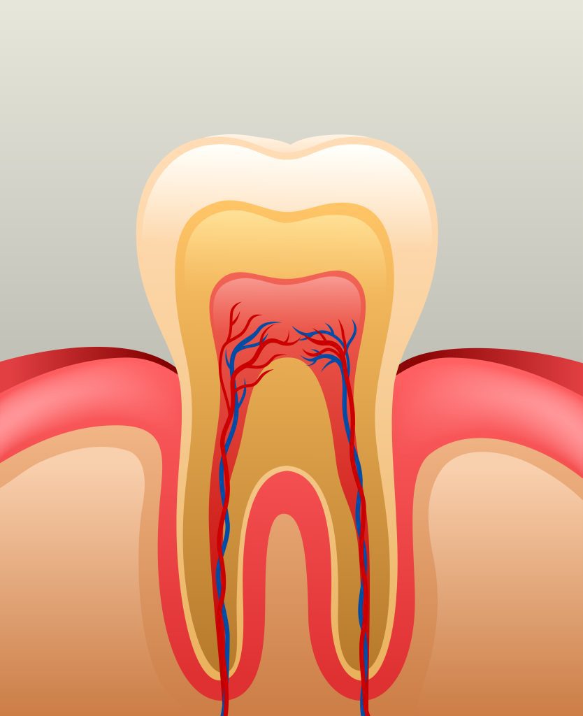 Reducing Root Canal Costs | Best Dental