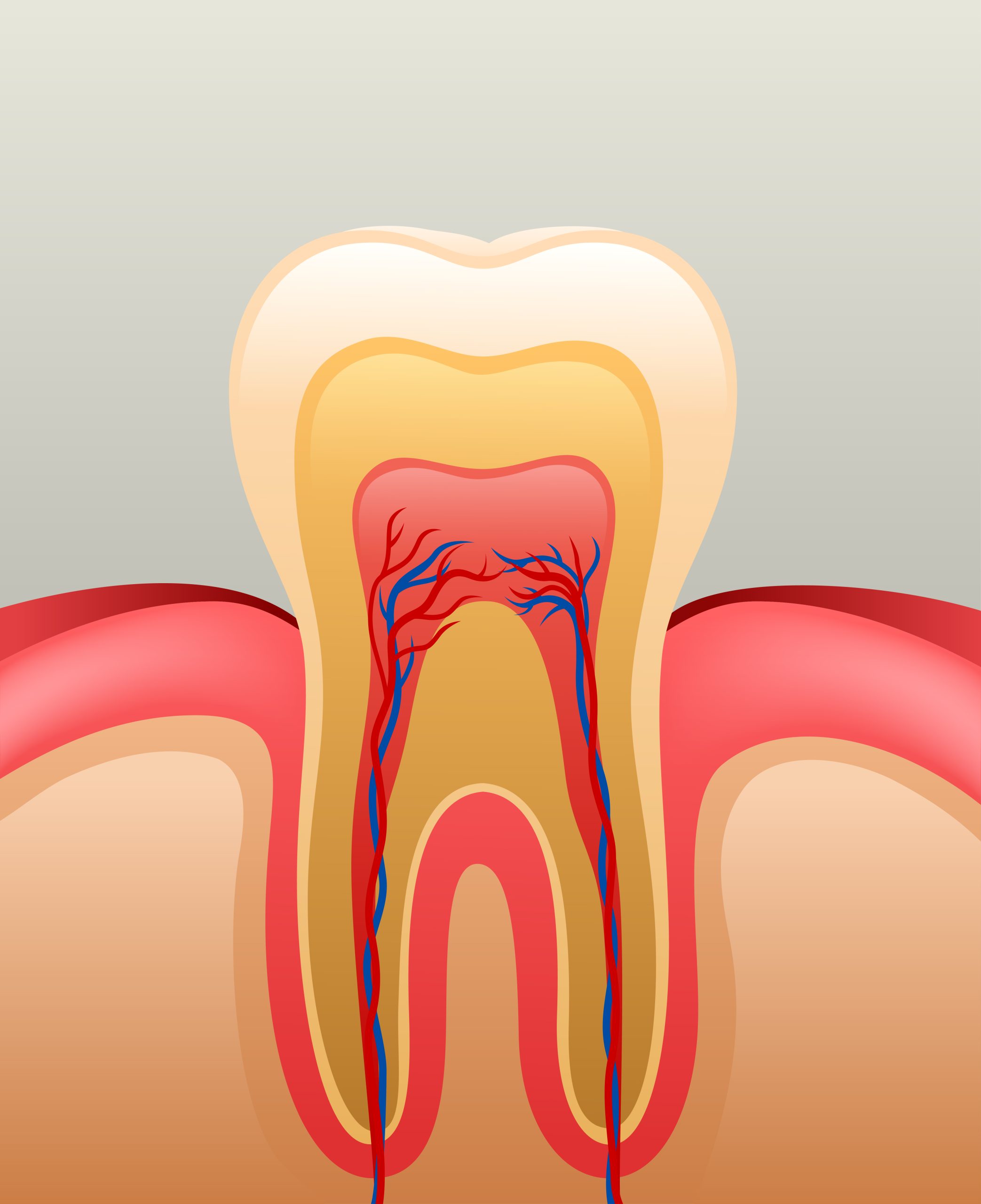 Reducing Root Canal Costs | Best Dental