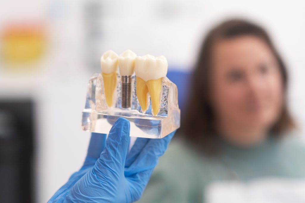 Hidden Fees Of Cheap Dental Implants | Best Dental