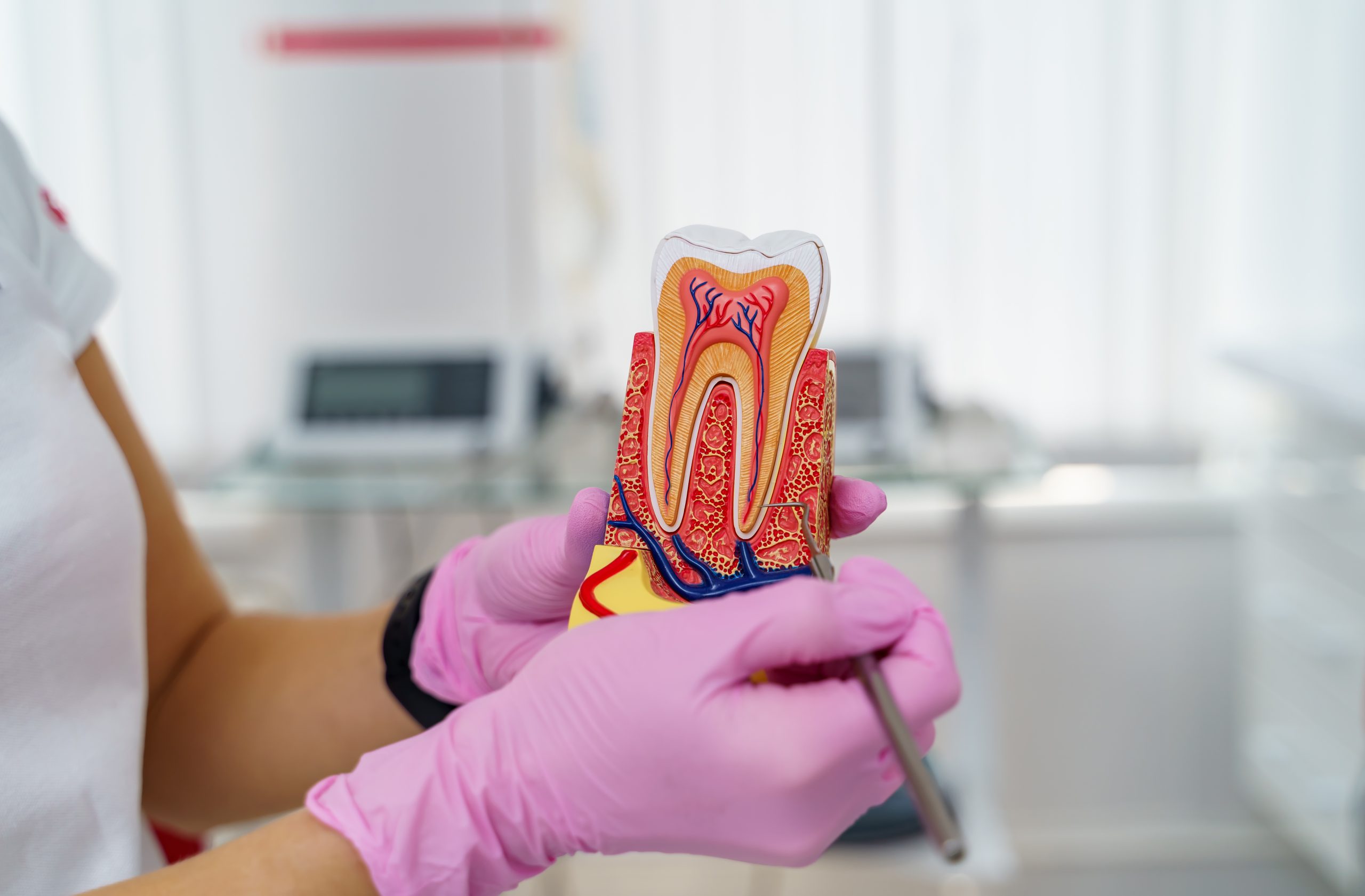 Reducing Root Canal Costs | Best Dental