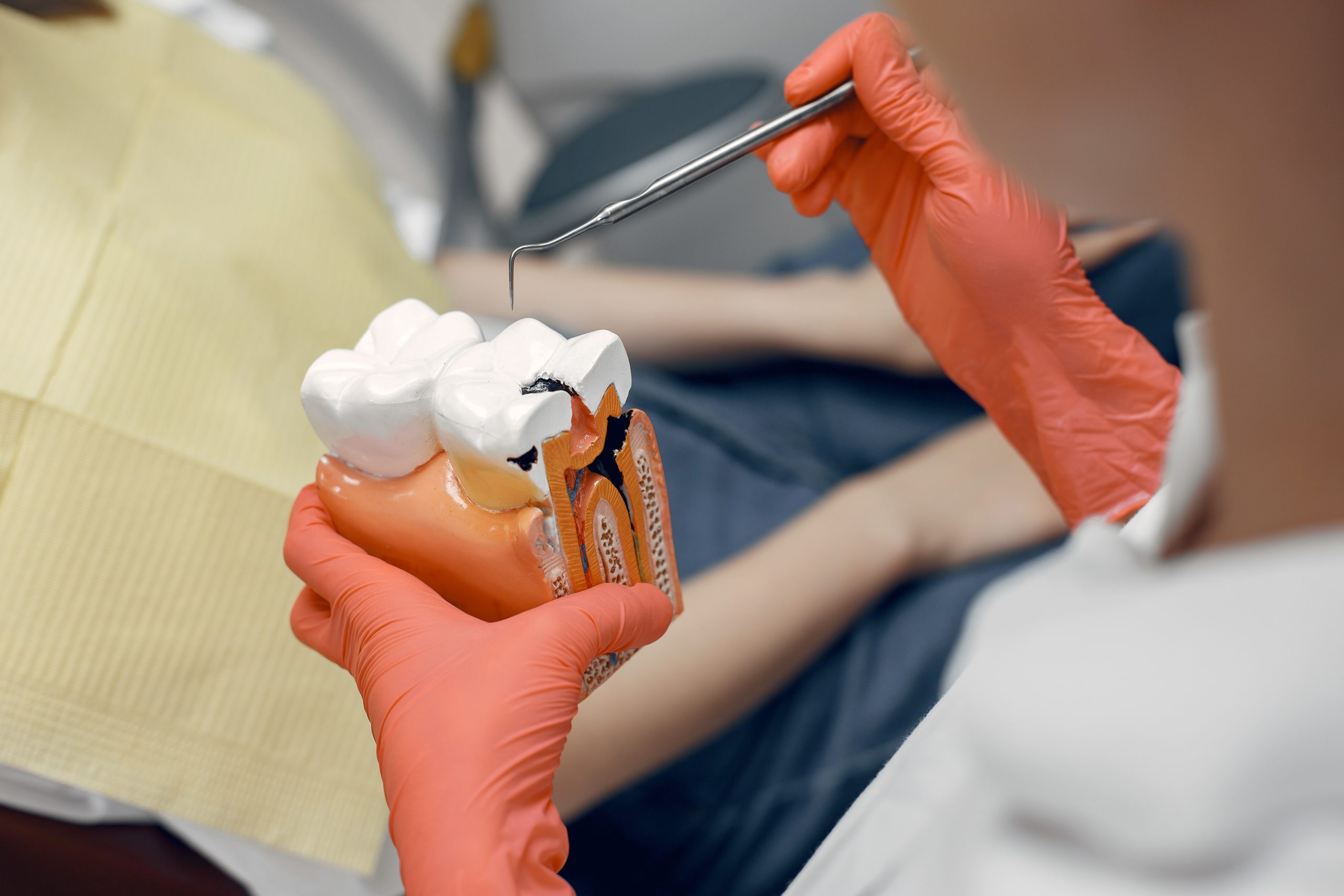 Reducing Root Canal Costs | Best Dental