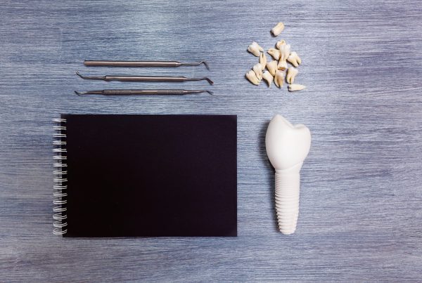 Dental Implants Bad Credit | Best Dental