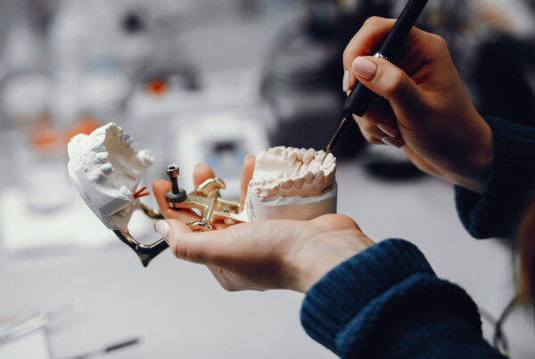 Dental Implants Cost 2026 | Best Dental Houston, TX