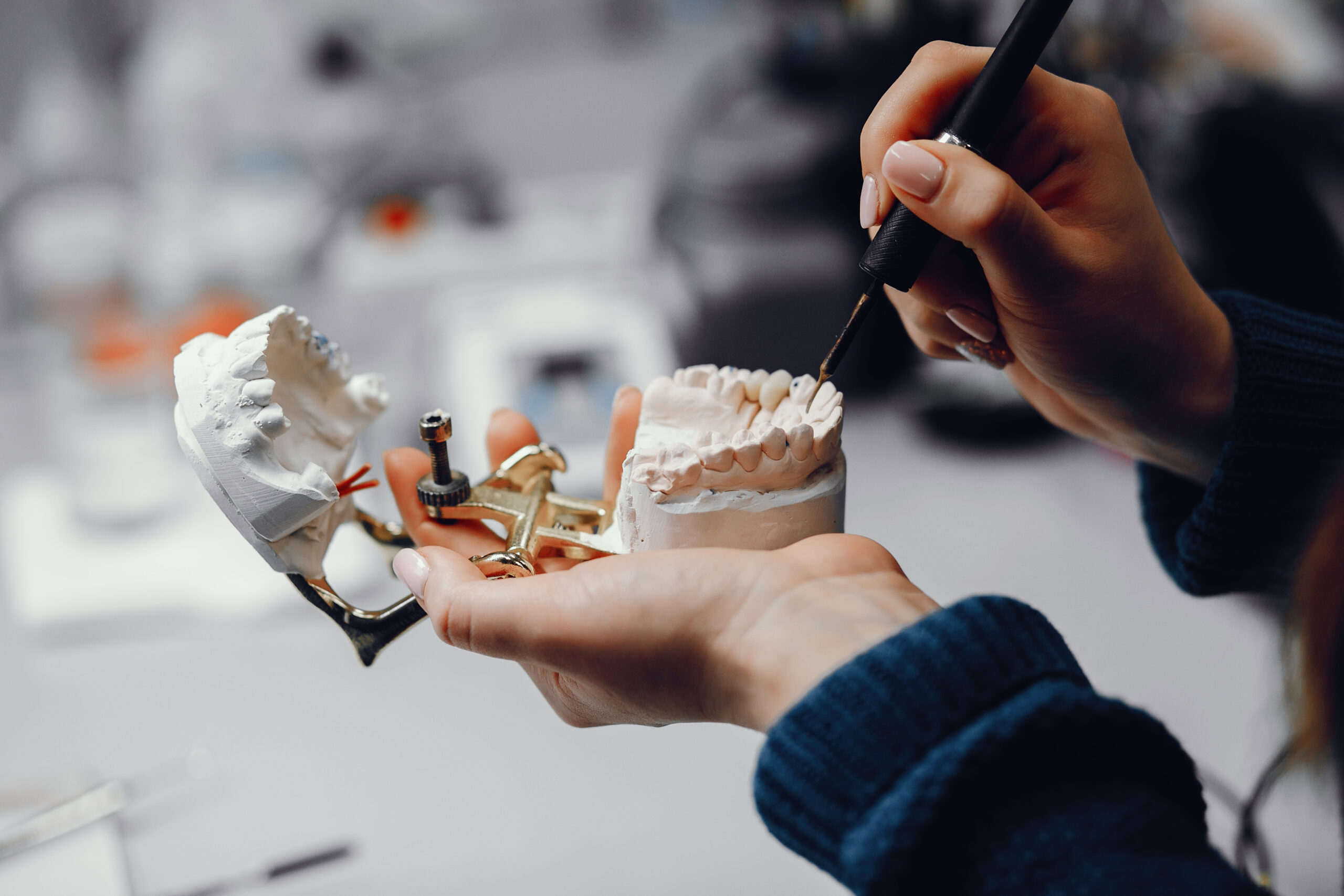 Dental Implants Cost 2026 | Best Dental Houston, TX