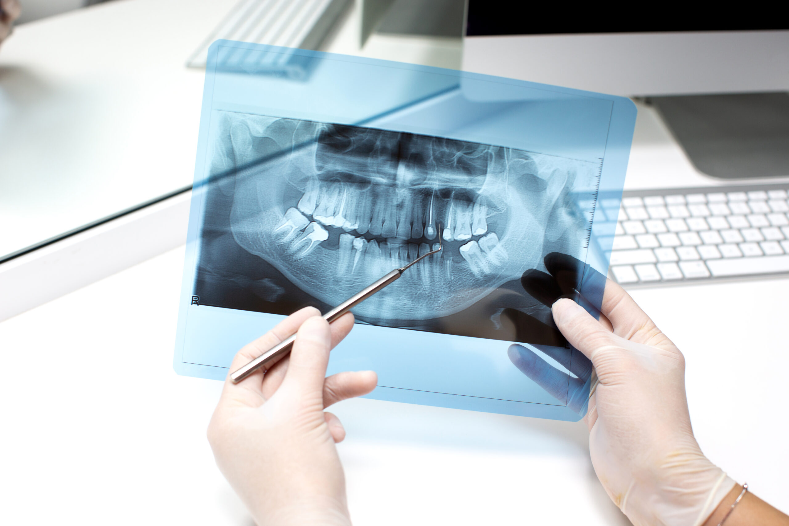 Finding A Great Female Dentist | Best Dental Houston, TX