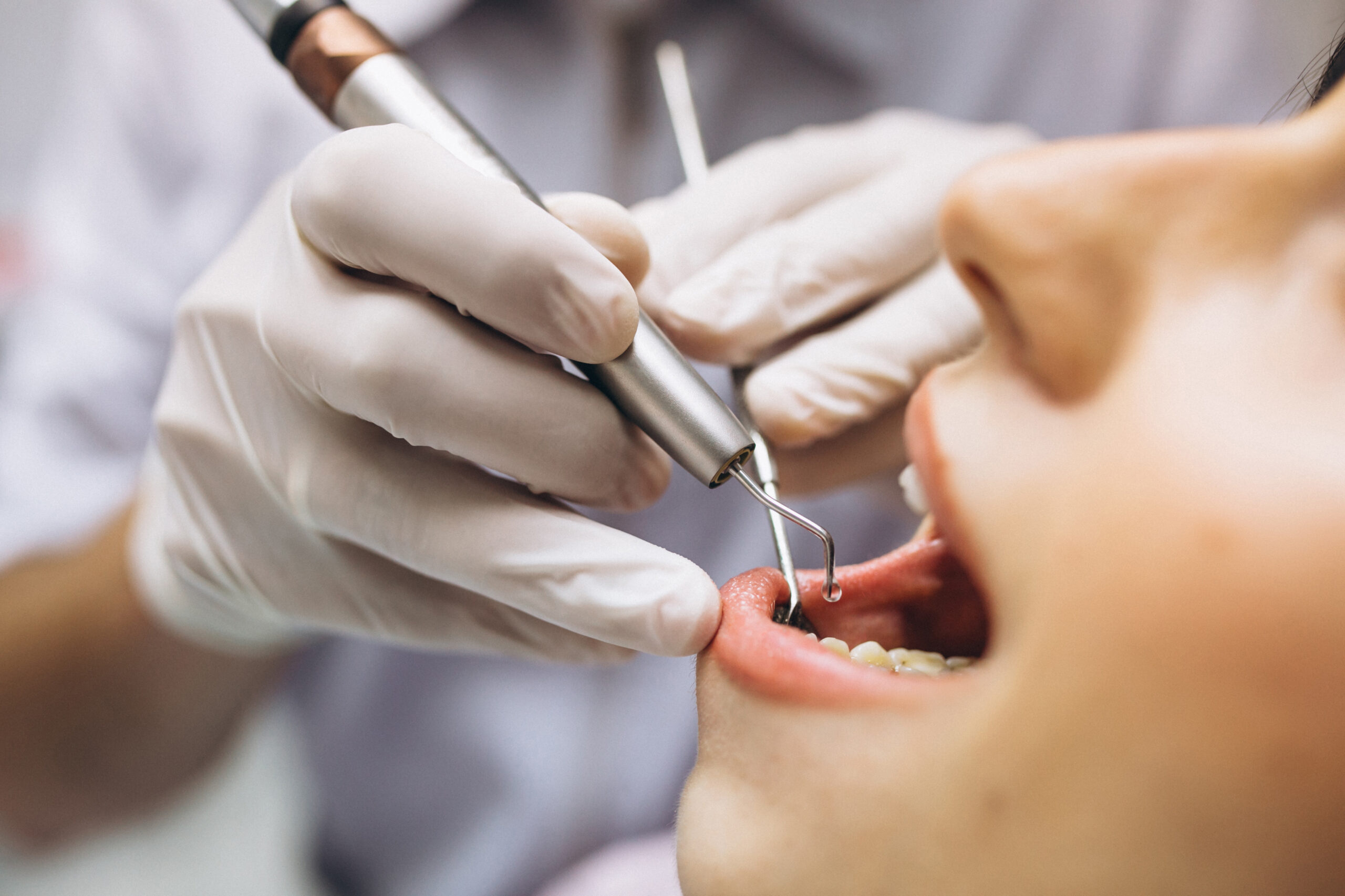 Finding A Great Female Dentist | Best Dental Houston, TX