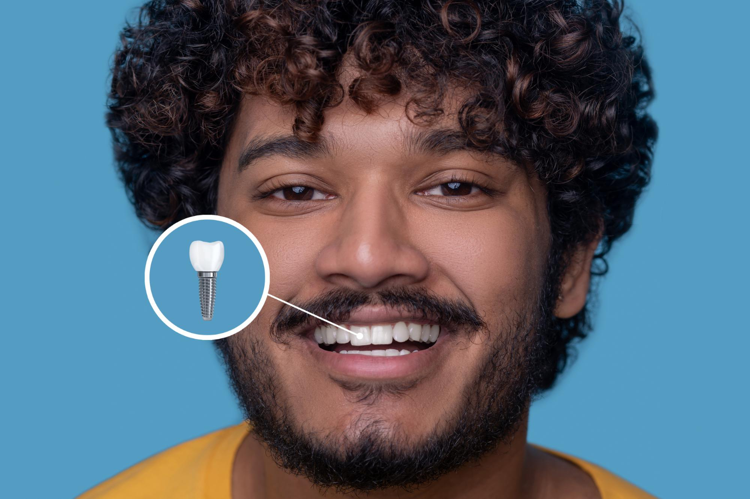 Dental implants Houston TX — Best Dental
